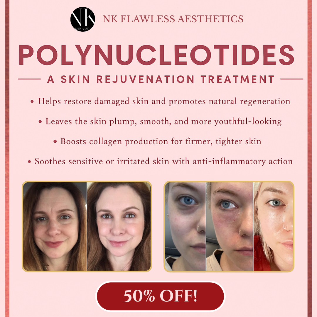 NK & co flawless aesthetics Facebook ad