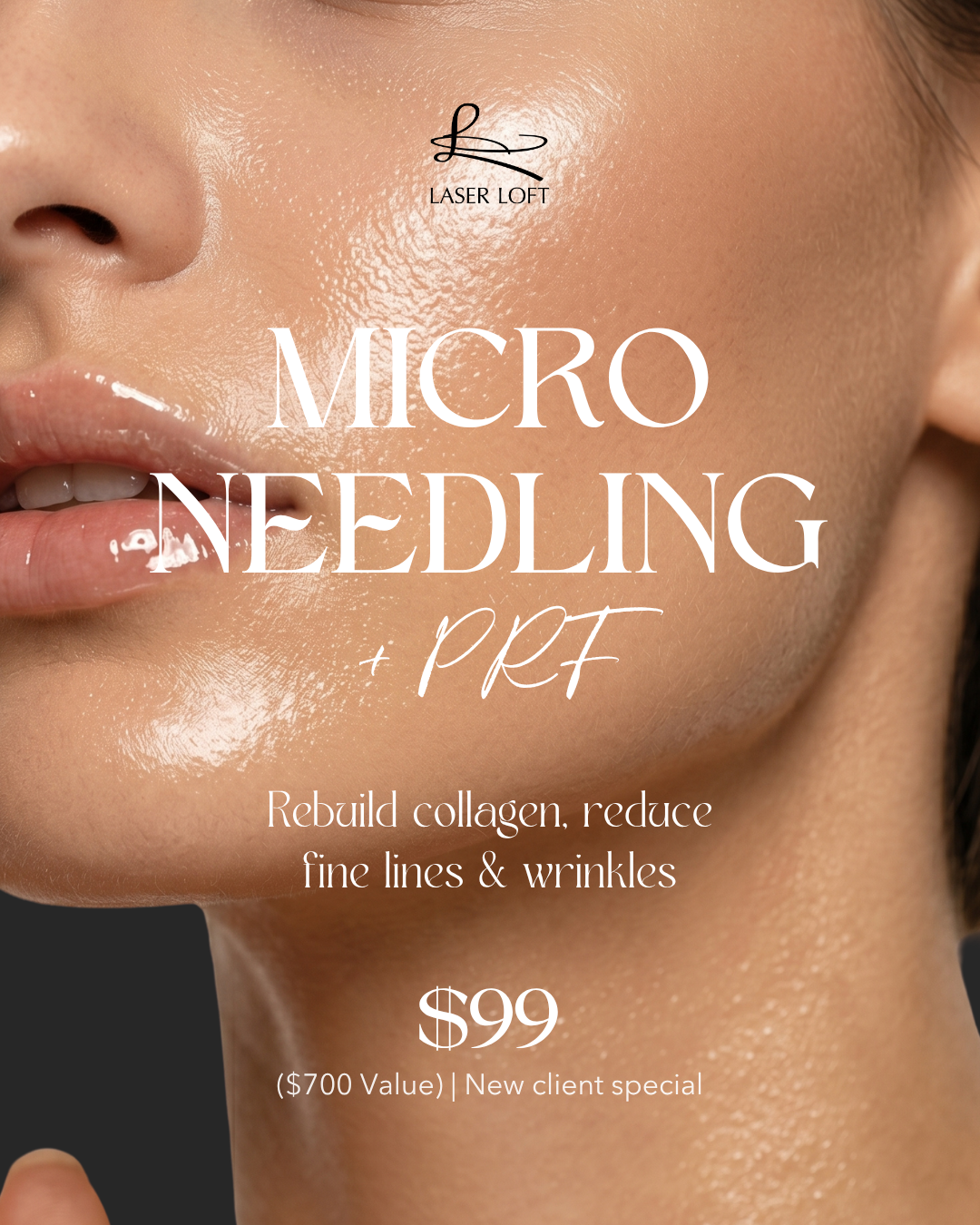 Laser Loft Facebook ad