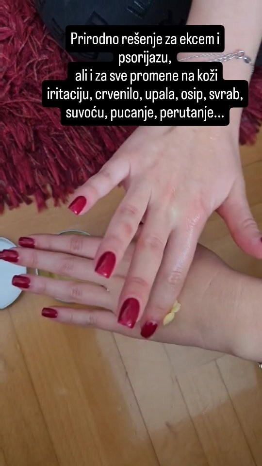 Biljna Sinergija Prirodni Melemi Facebook ad: MELEM ZA TRETMAN EKCEMA I PSORIJAZE