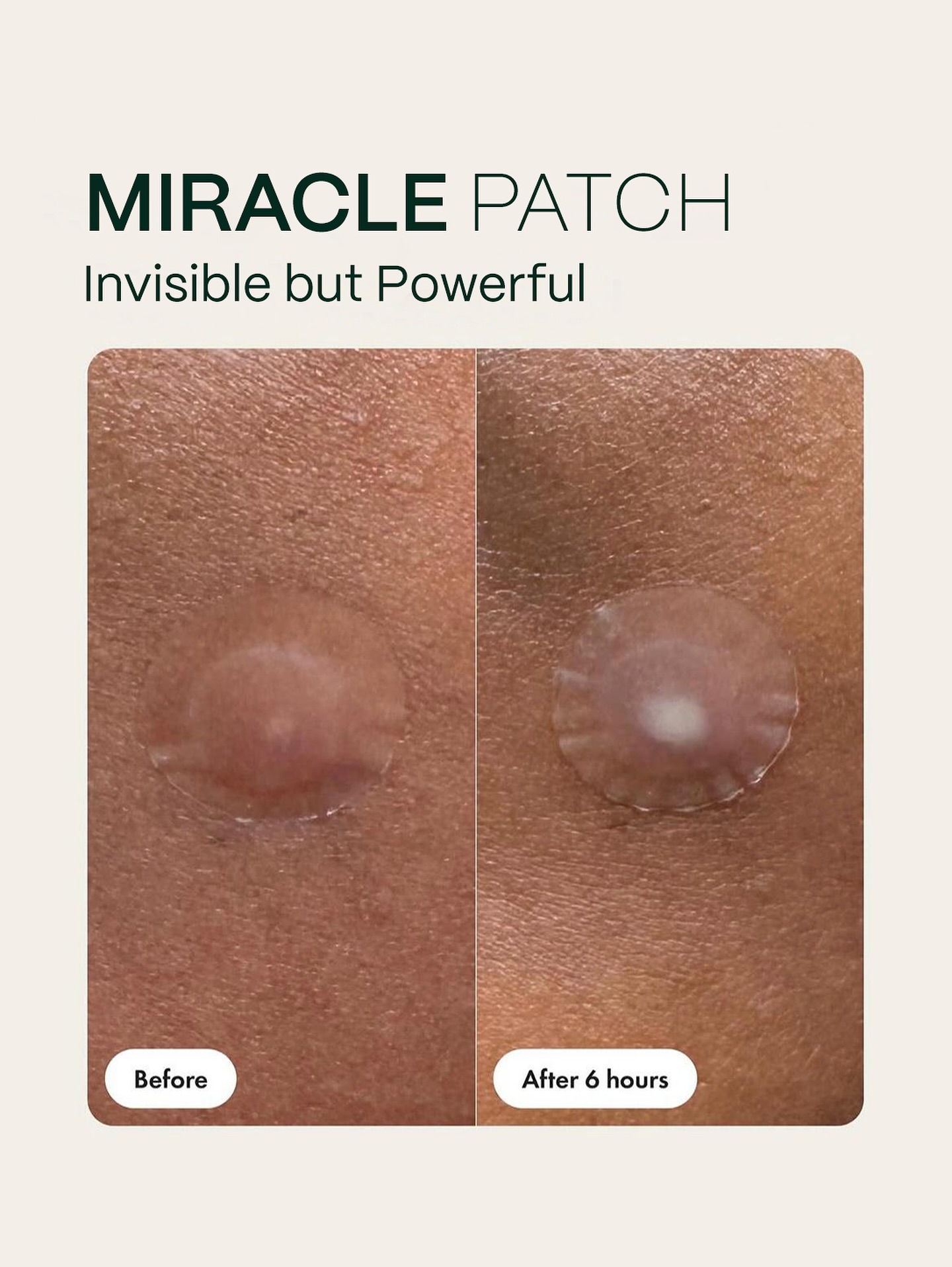 Skin Deep Facebook ad