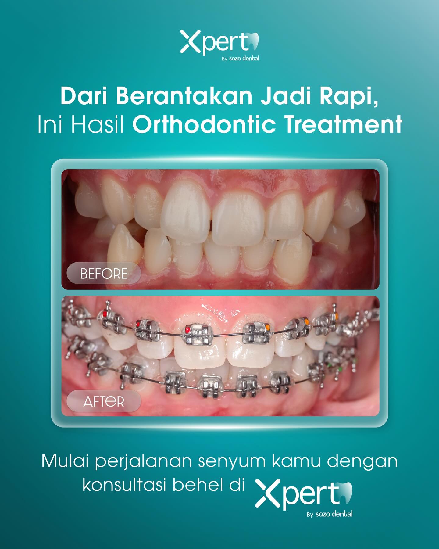 XPERT by Sozo Dental Clinic Facebook ad