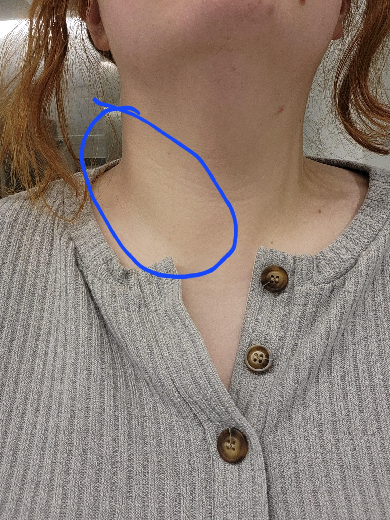 Cindy Roddey Facebook ad: Read This If Your Doctor Said Your Thyroid Is Normal But…