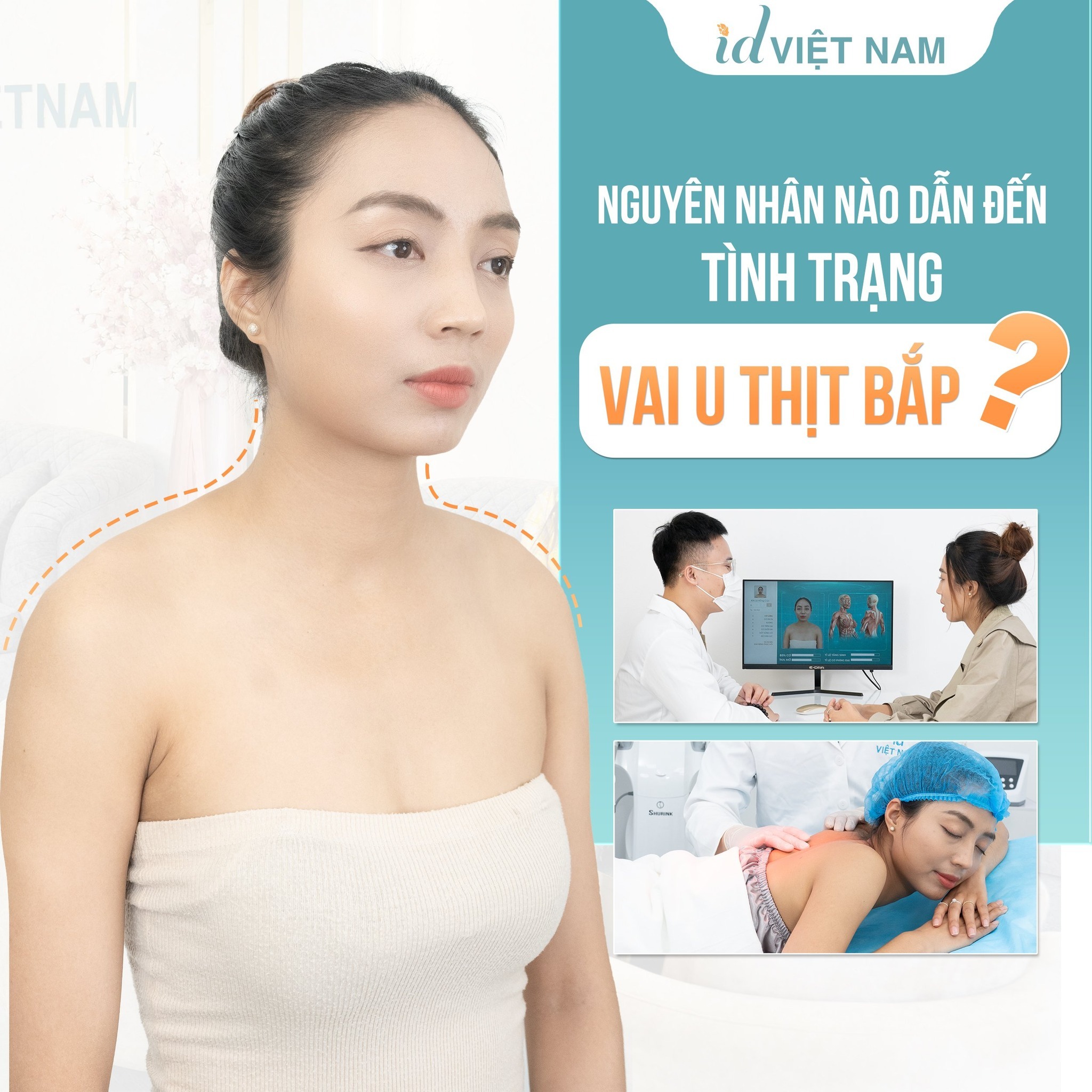 Viện Thẩm Mỹ ID Việt Nam - Xoá Bỏ Vai U, Cổ rùa, Bắp Tay To Số 1 Hà Nội Facebook ad: NGUYÊN NHÂN NÀO DẪN ĐẾN TÌNH TRẠNG VAI…