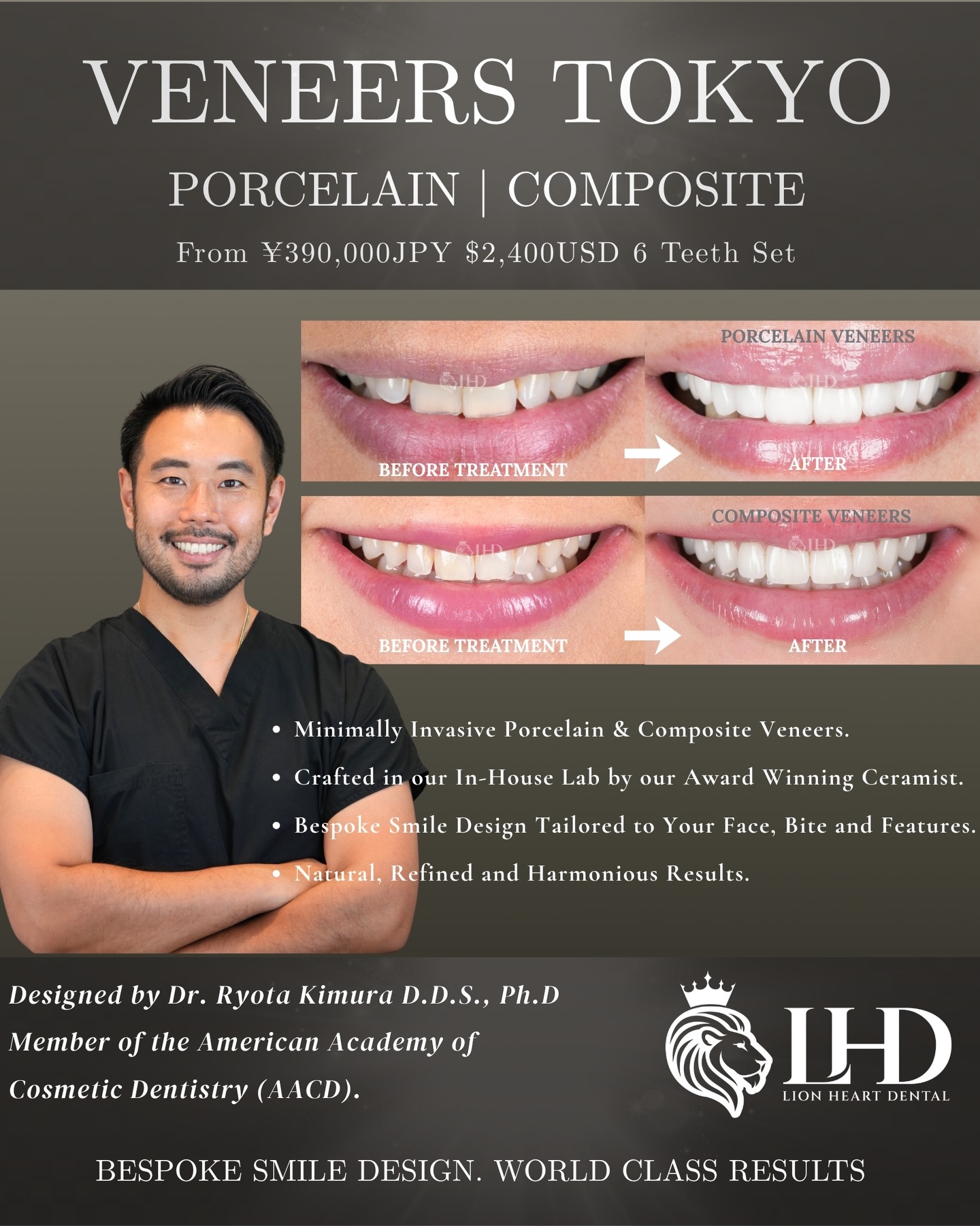 lionheartdentaltokyo Facebook ad: Handcrafted veneers, designed with precision.