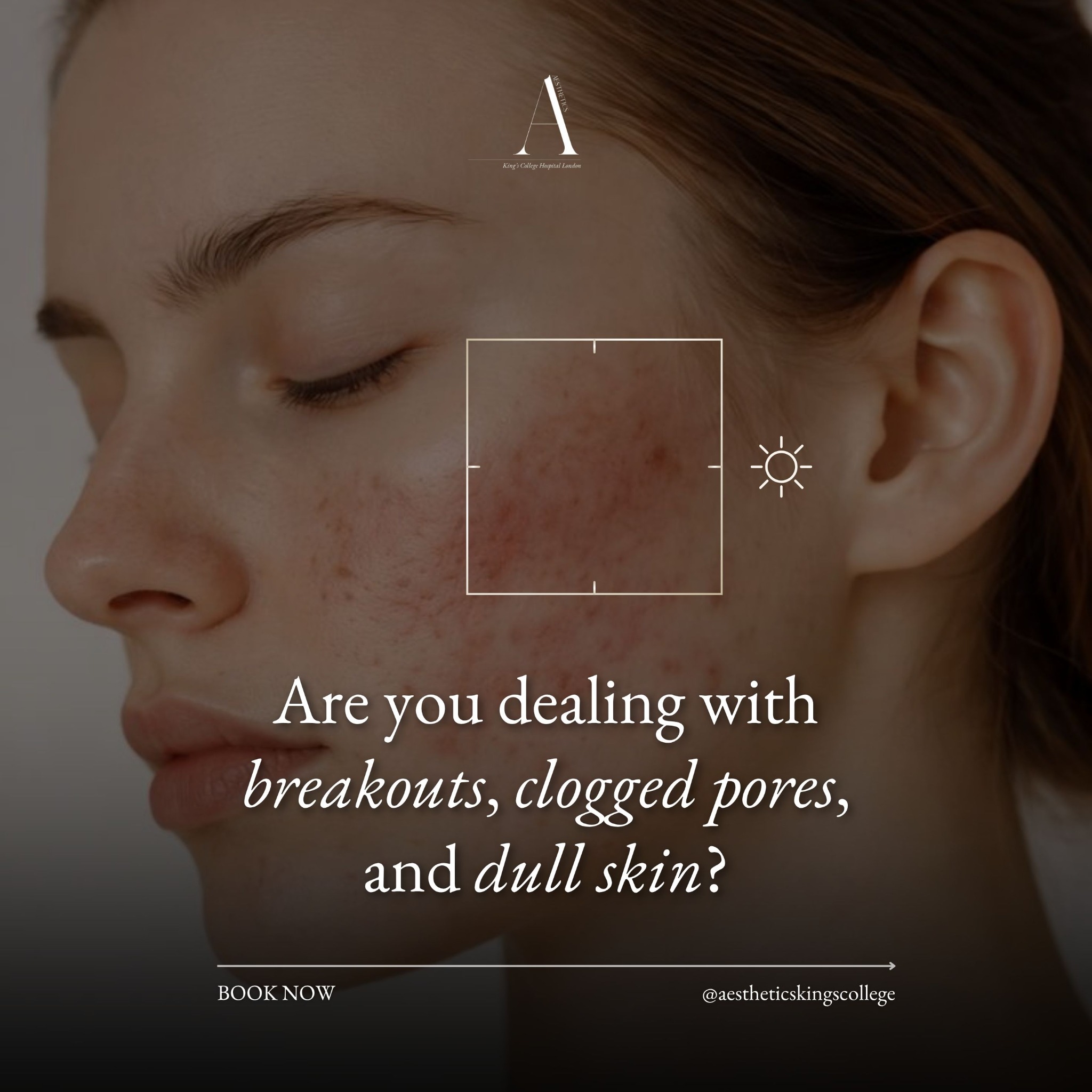 Aesthetics By Kings College Hospital London Facebook ad