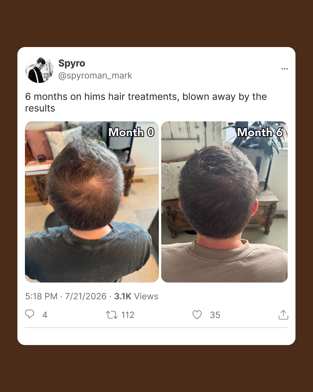 hims Facebook ad