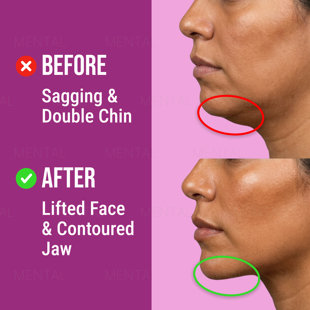Mimika - Face Yoga Exercises Facebook ad