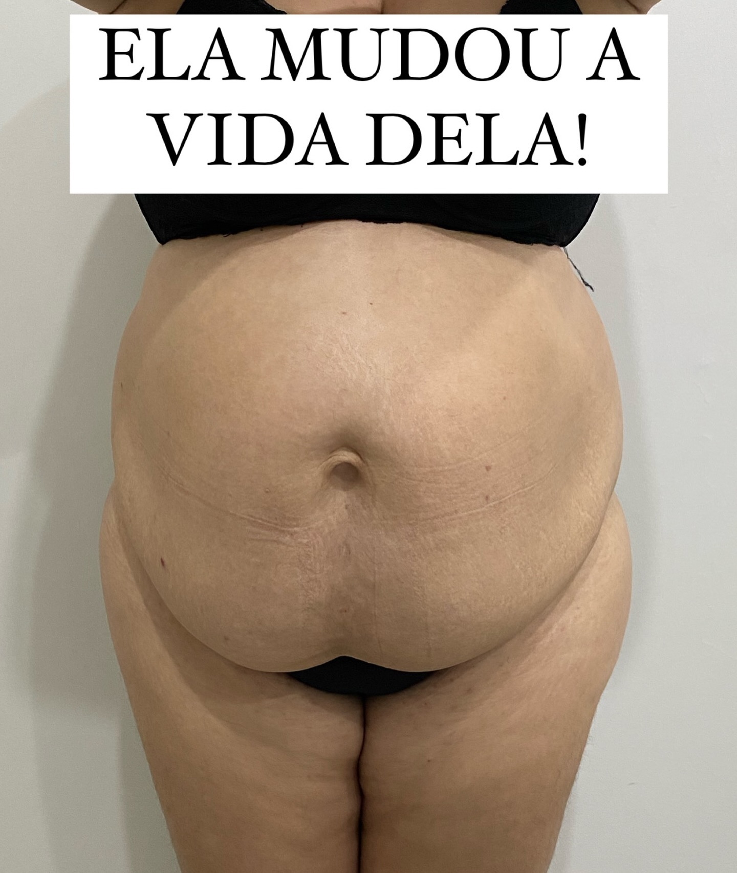 Royal Rejuv Clínica Estética Facebook ad: Transformação da vida, é o nosso foco!