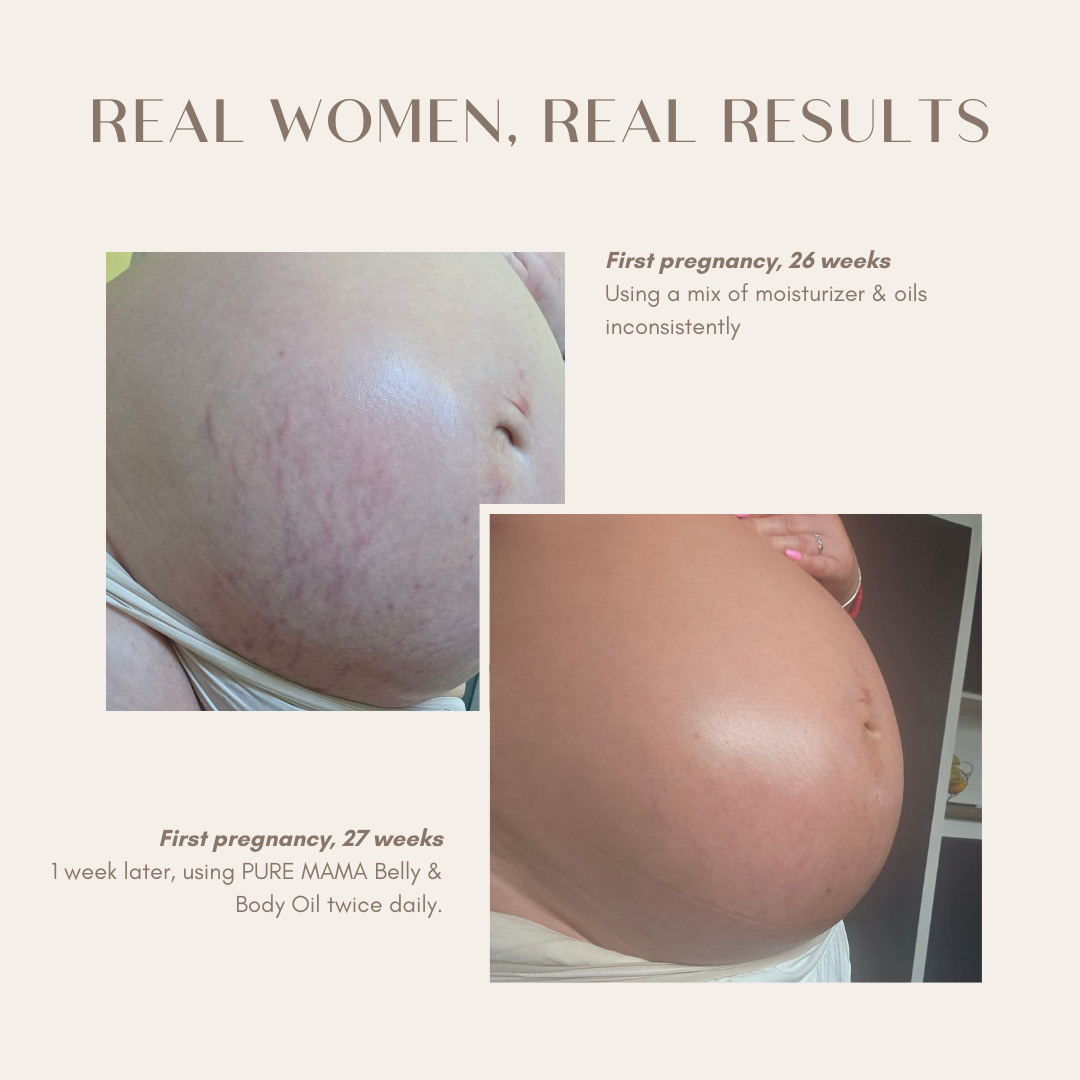 PURE MAMA Skincare Facebook ad