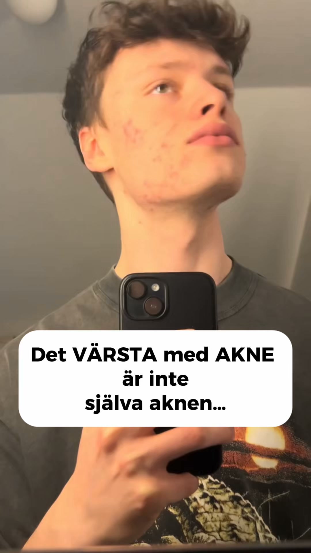 LovieBaby Facebook ad: Naturlig hudvård för akne