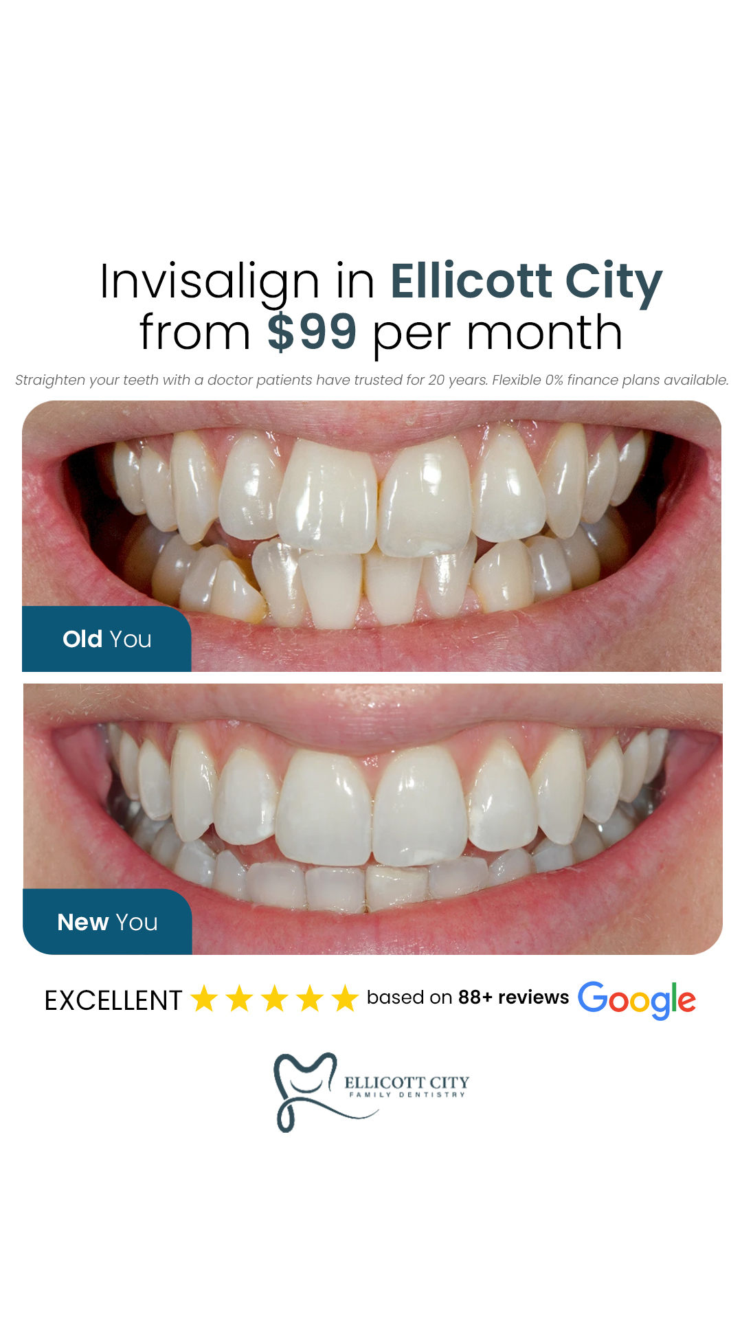 Ellicott City Family Dentistry Facebook ad from Jun 1, 2026