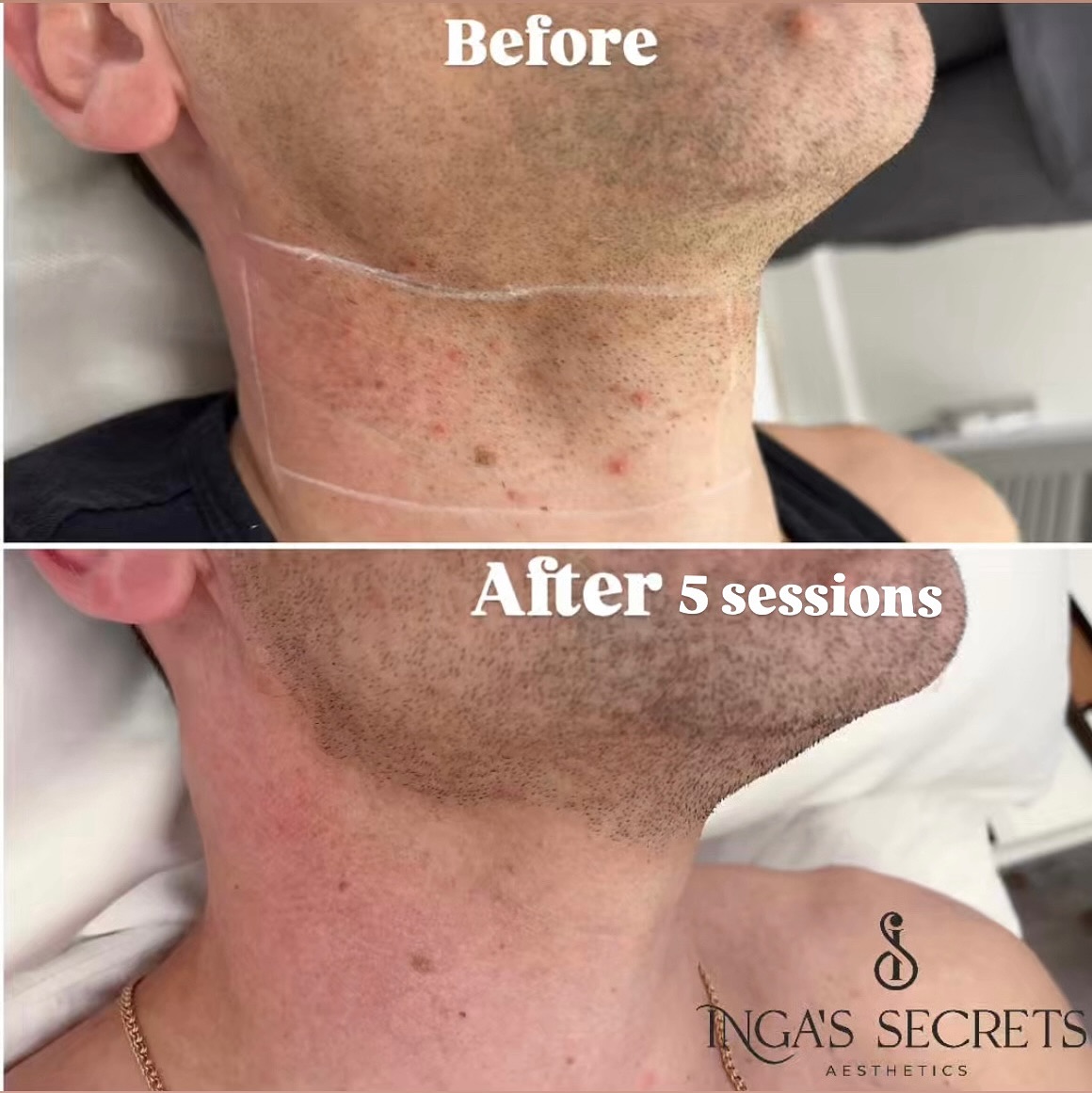 Inga's Secrets Aesthetics Facebook ad