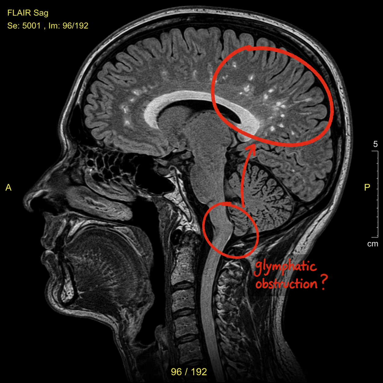 The Migraine Nightshift Report Facebook ad