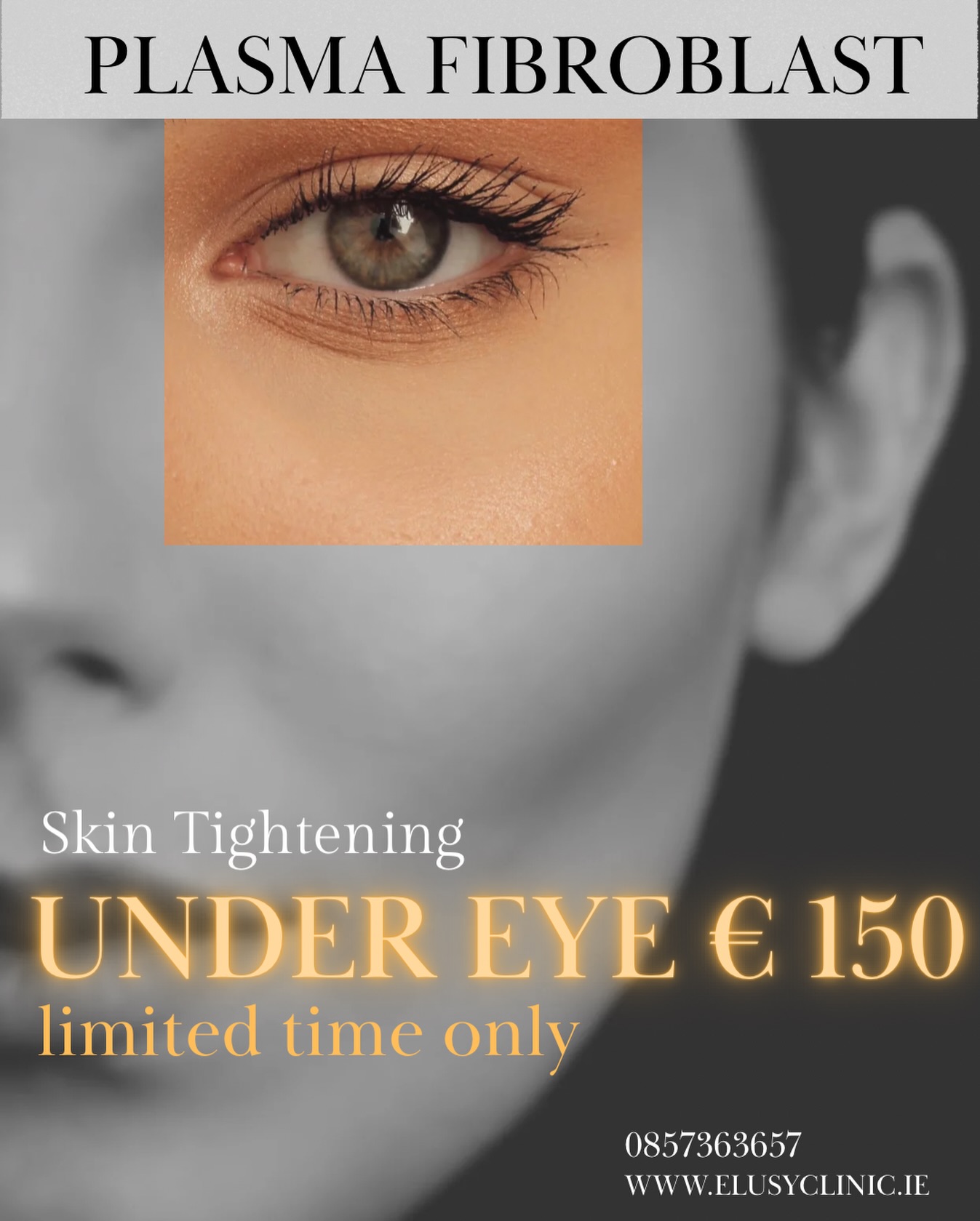 Elusyclinic Facebook ad: Dublin €150 LIMITED TIME ONLY- Plasma Fibroblast