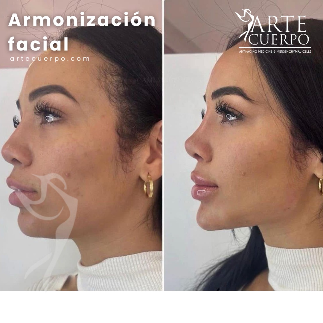 Clinica spa arte cuerpo  Facebook ad