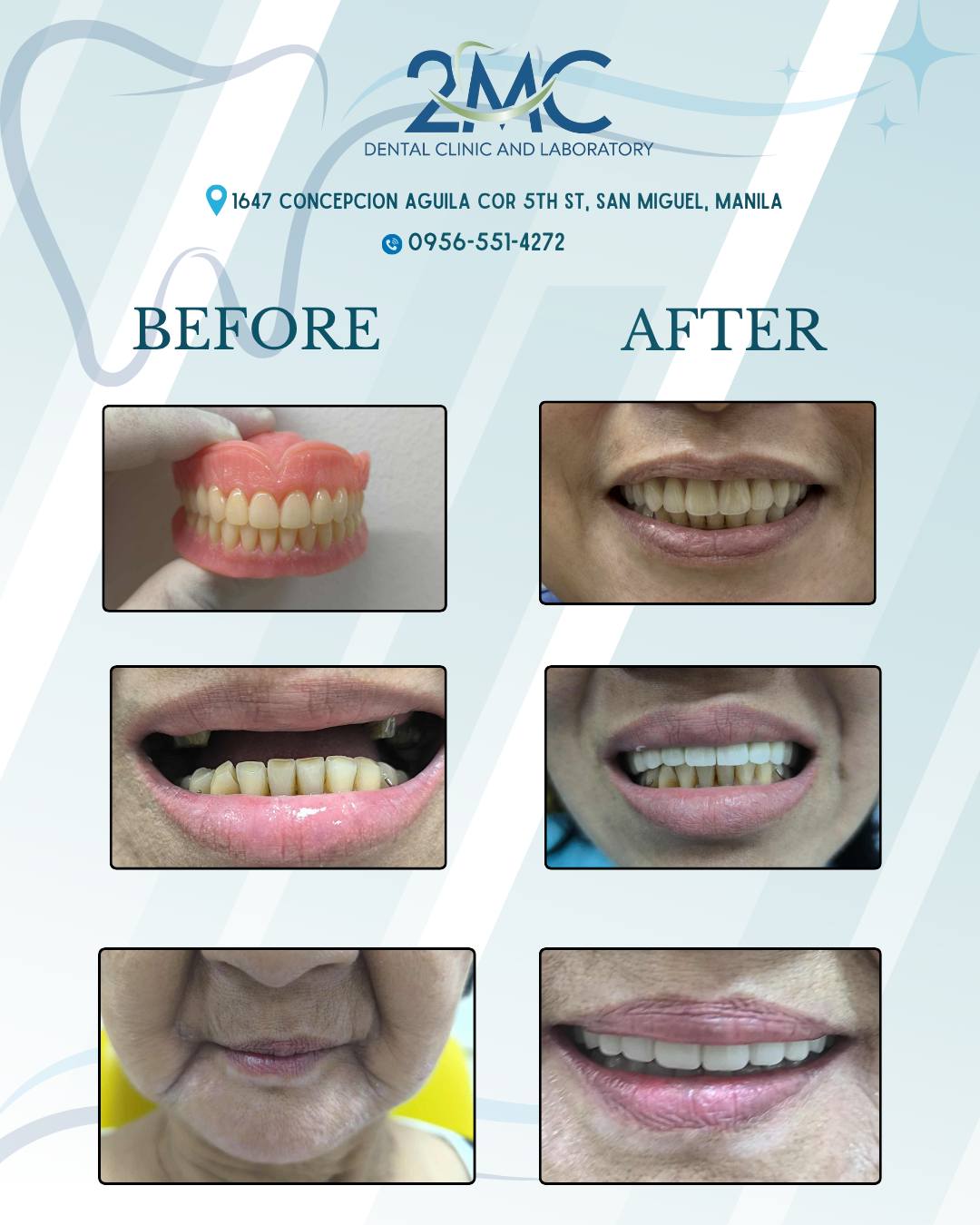 2MC Dental Clinic and Laboratory - Mendiola Facebook ad: LOOKING FOR AFFORDABLE DENTAL SERVICES?