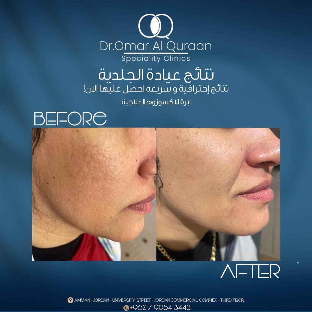 Dr.Omar Al-Quraan Speciality Clinics Group.Jo Facebook ad