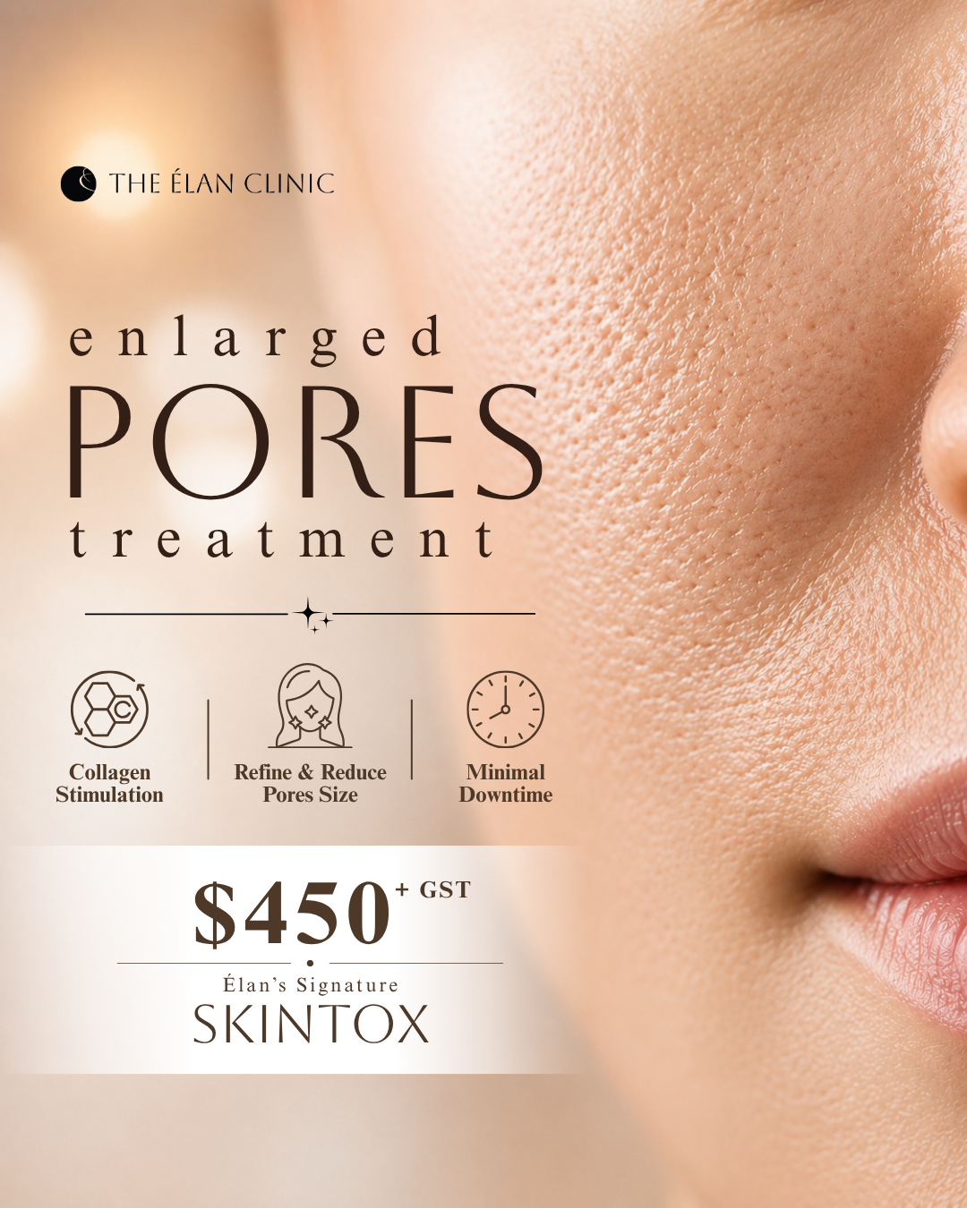 The Élan Clinic Facebook ad: Enlarged Pores Treatment @ $450+GST