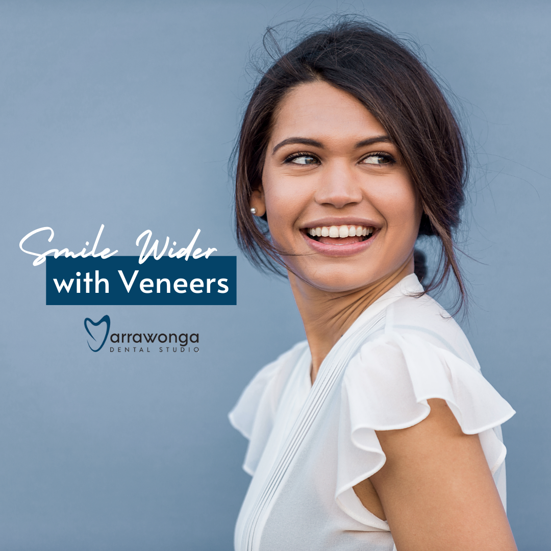 Yarrawonga Dental Studio Facebook ad
