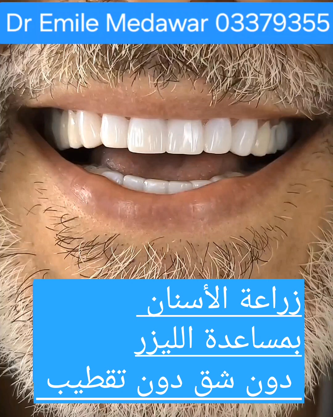 Style Beauty & Dental Clinic Dr. Medawar Facebook ad: زراعة الأسنان لبنان