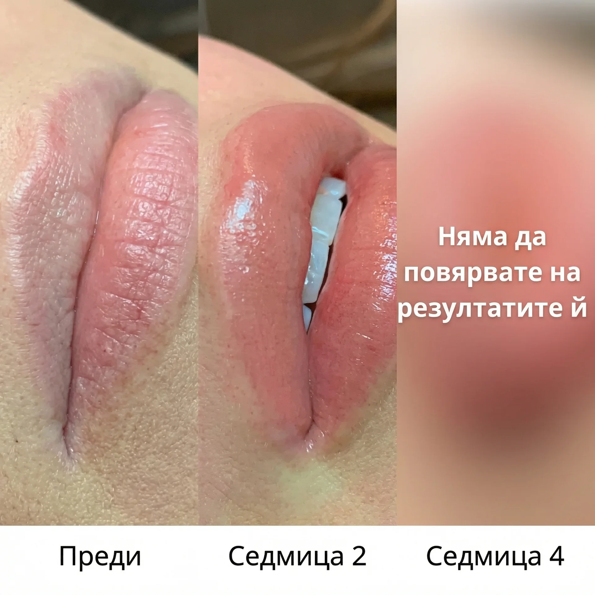 Vitalaiz Естетичен център Facebook ad