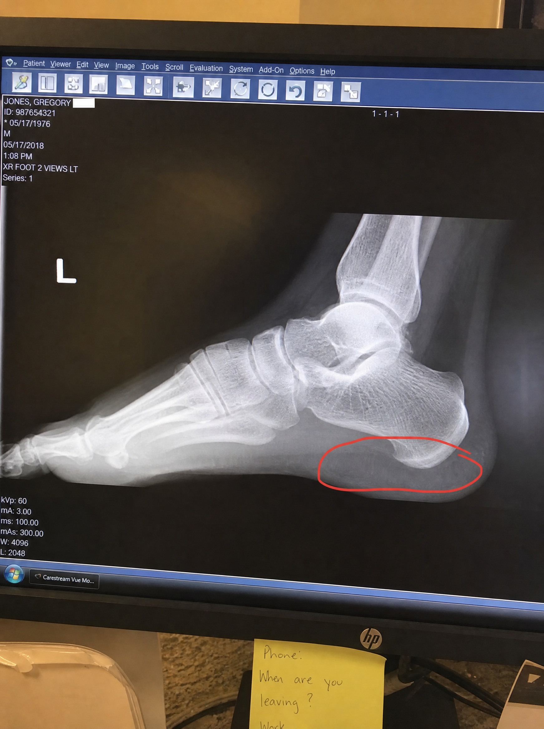 Chase Welmer Facebook ad: i was wrong about my own feet