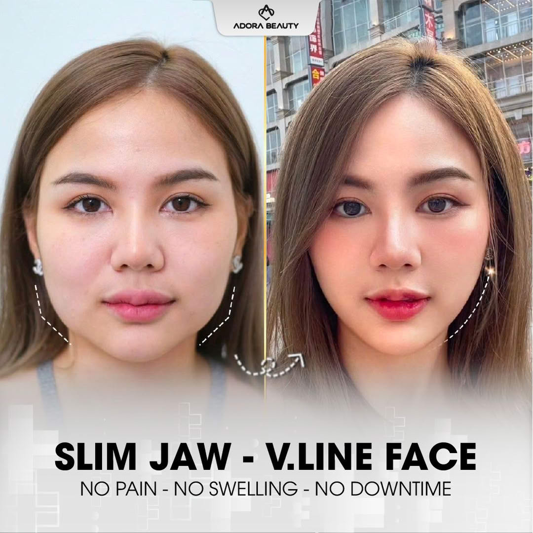 ADORA Beauty - No. 1 Dermatology salon in Manila Facebook ad