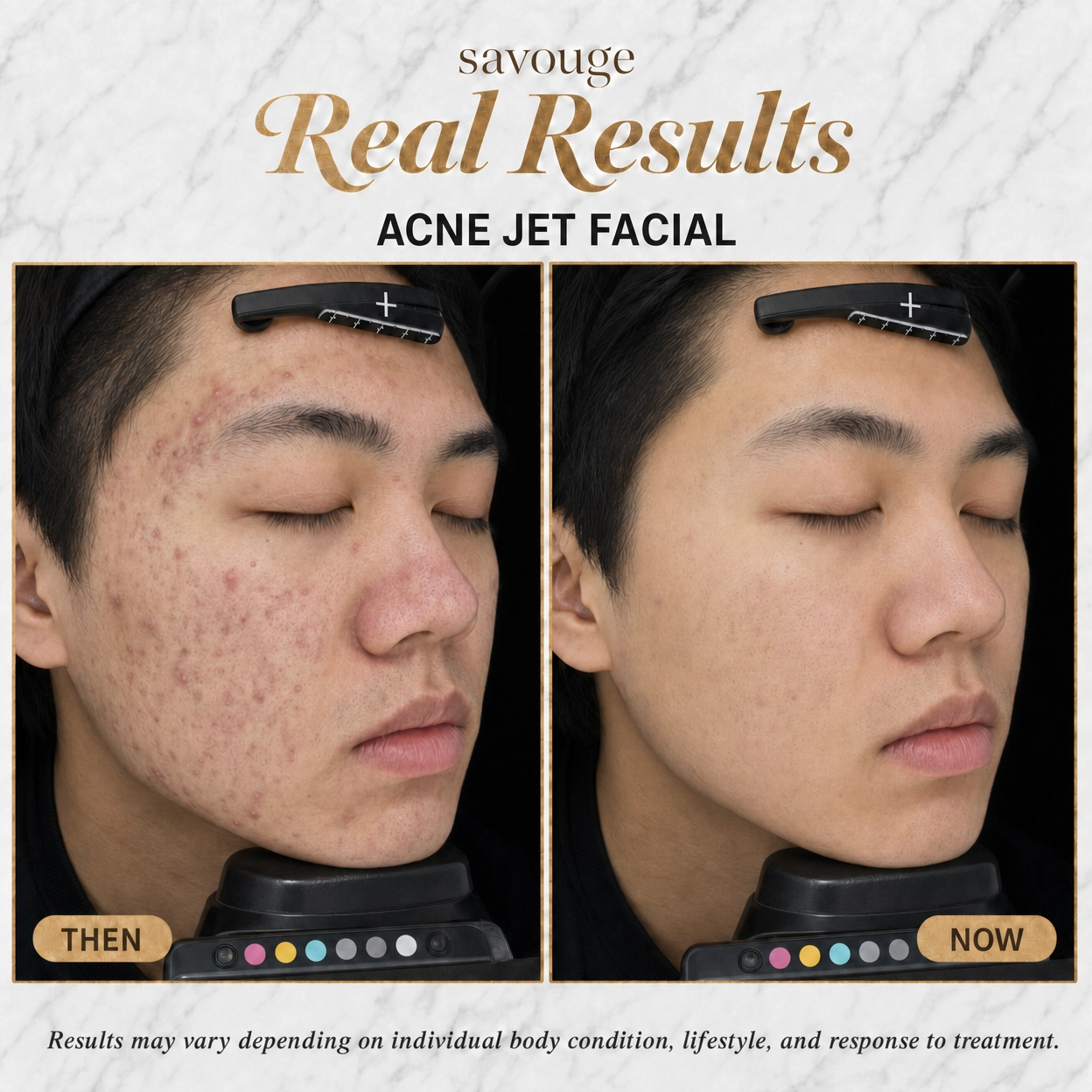 Savouge Aesthetics Pasig Facebook ad