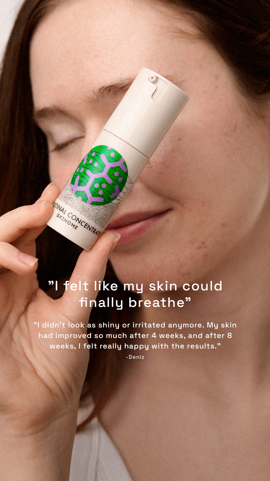 Skinome Facebook ad