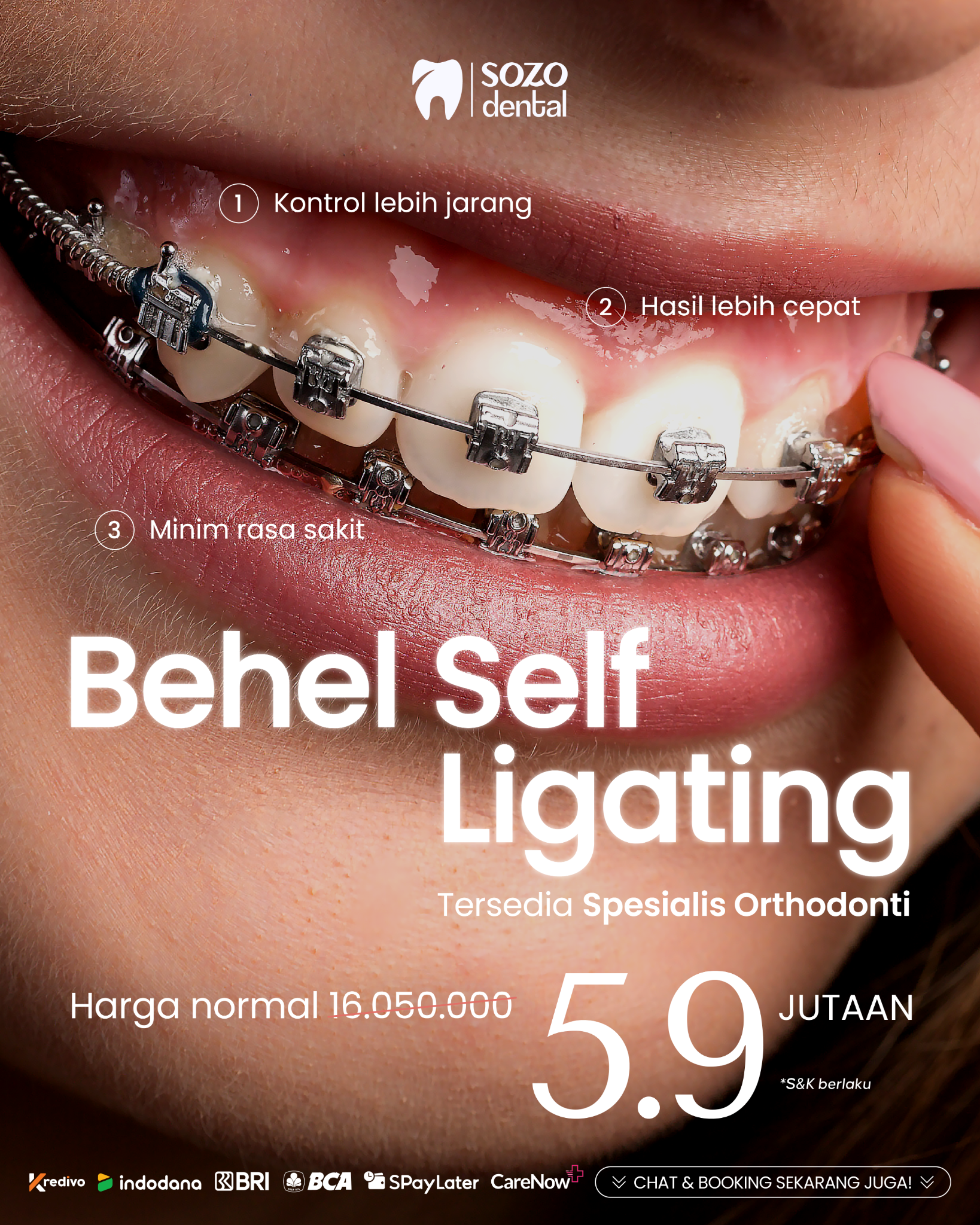 Sozo Dental Clinic Facebook ad