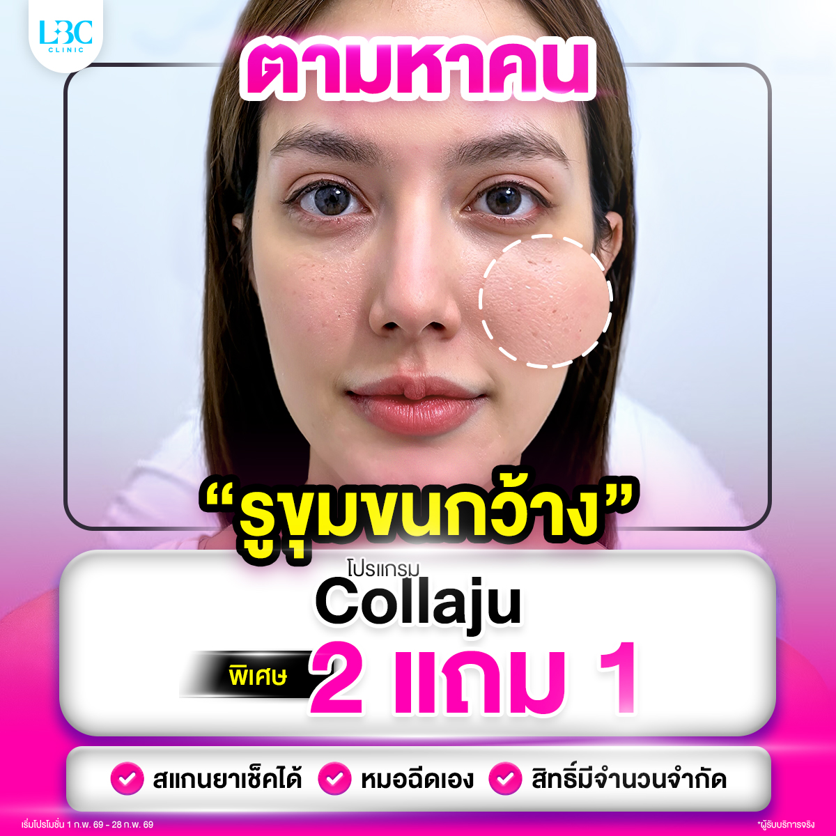 LBC Clinic เลอบิวทิส Facebook ad