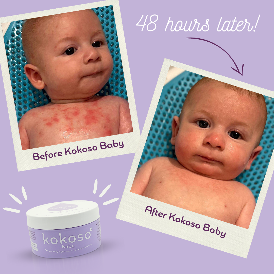 Kokoso Baby Facebook ad