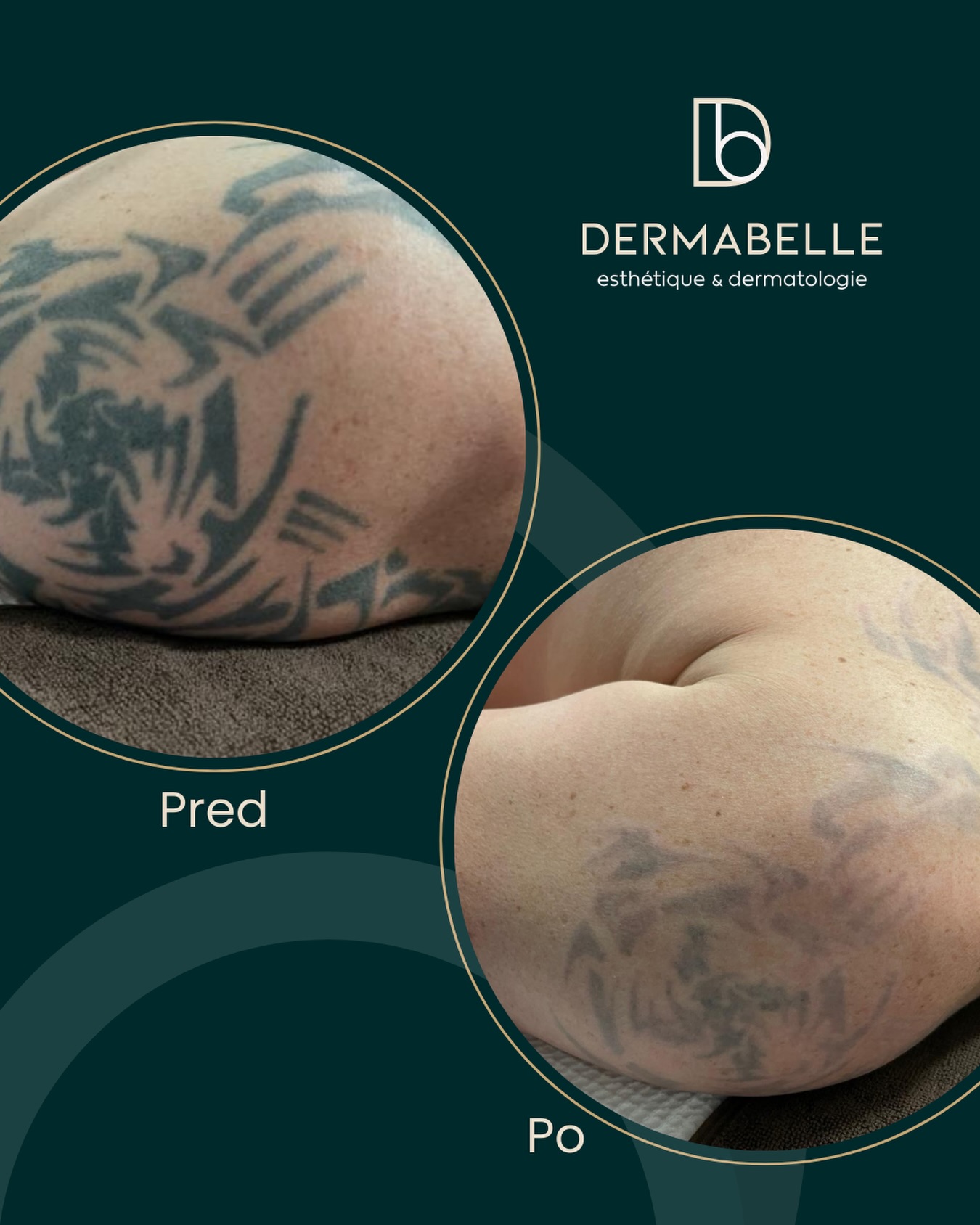 Dermabelle Facebook ad