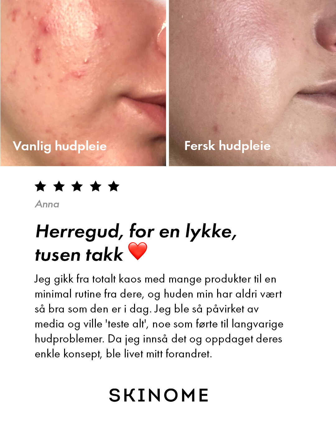 Skinome Facebook ad