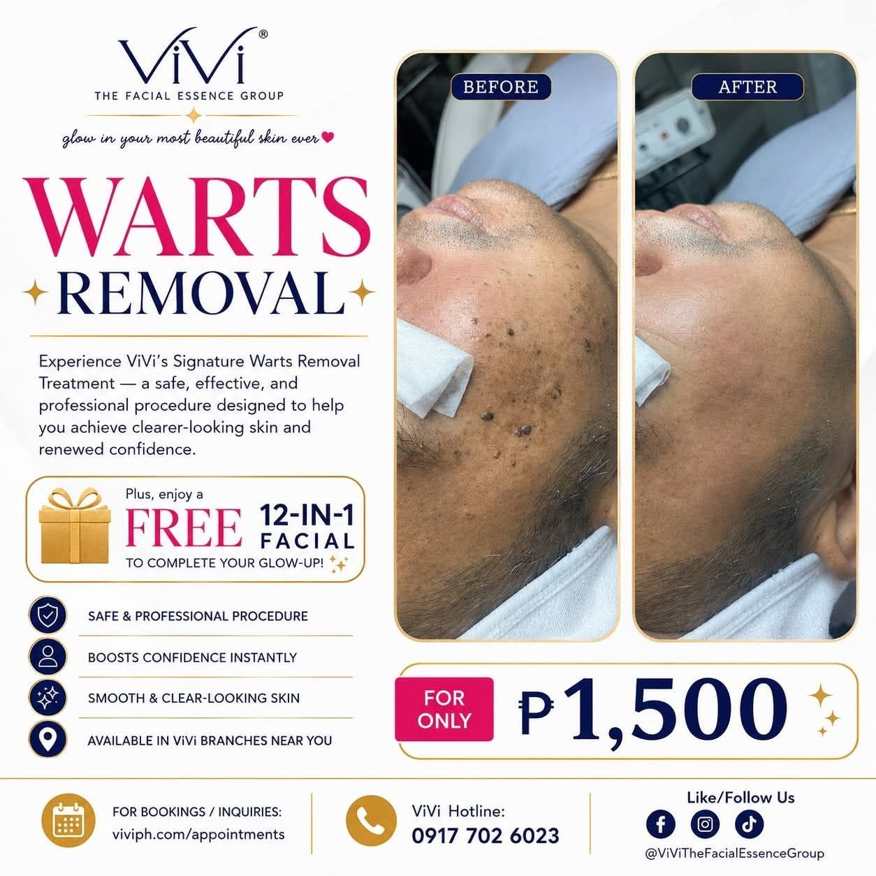 ViVi The Facial Essence Group Facebook ad