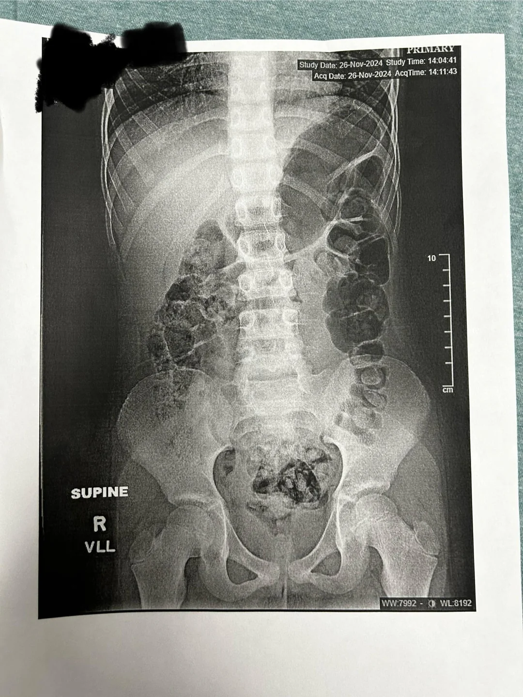 Better Digestion Daily Facebook ad