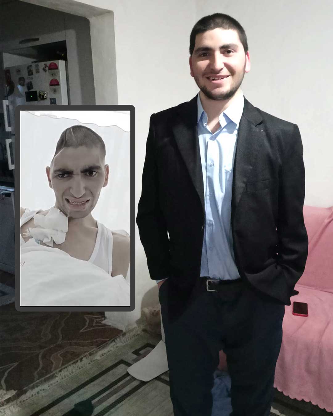Uzm. Dr. Halil Olgün Peker Facebook ad: Samet'in 9 ay içindeki gelişimine bakar mısınız?