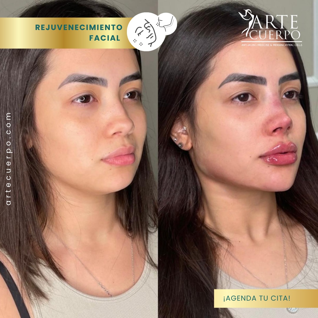 Clinica spa arte cuerpo  Facebook ad
