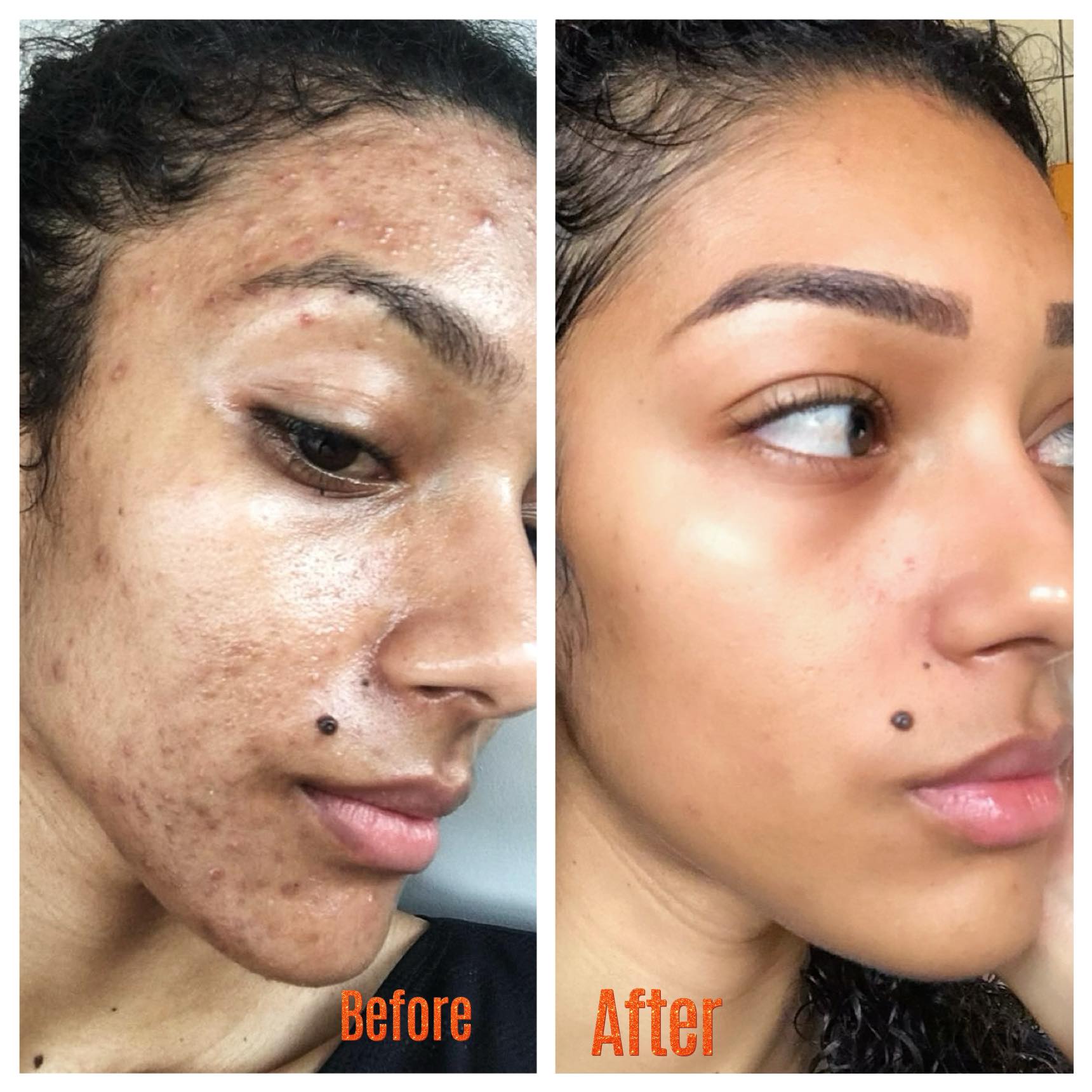 Glow Treatments Facebook ad: Skin එකේ ප්රශ්න නිසා ඔයත් ඉන්නේ දුකින් වේදනාවෙන්ද?