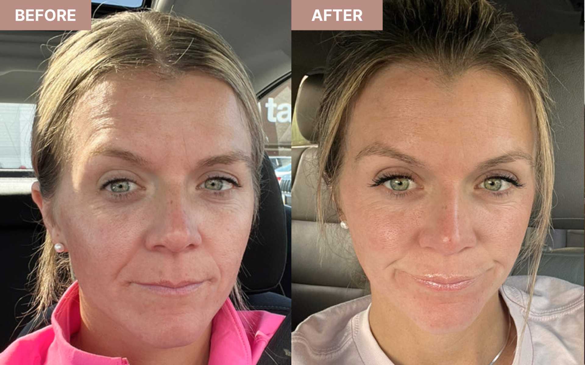 Rocky Health Inc Facebook ad