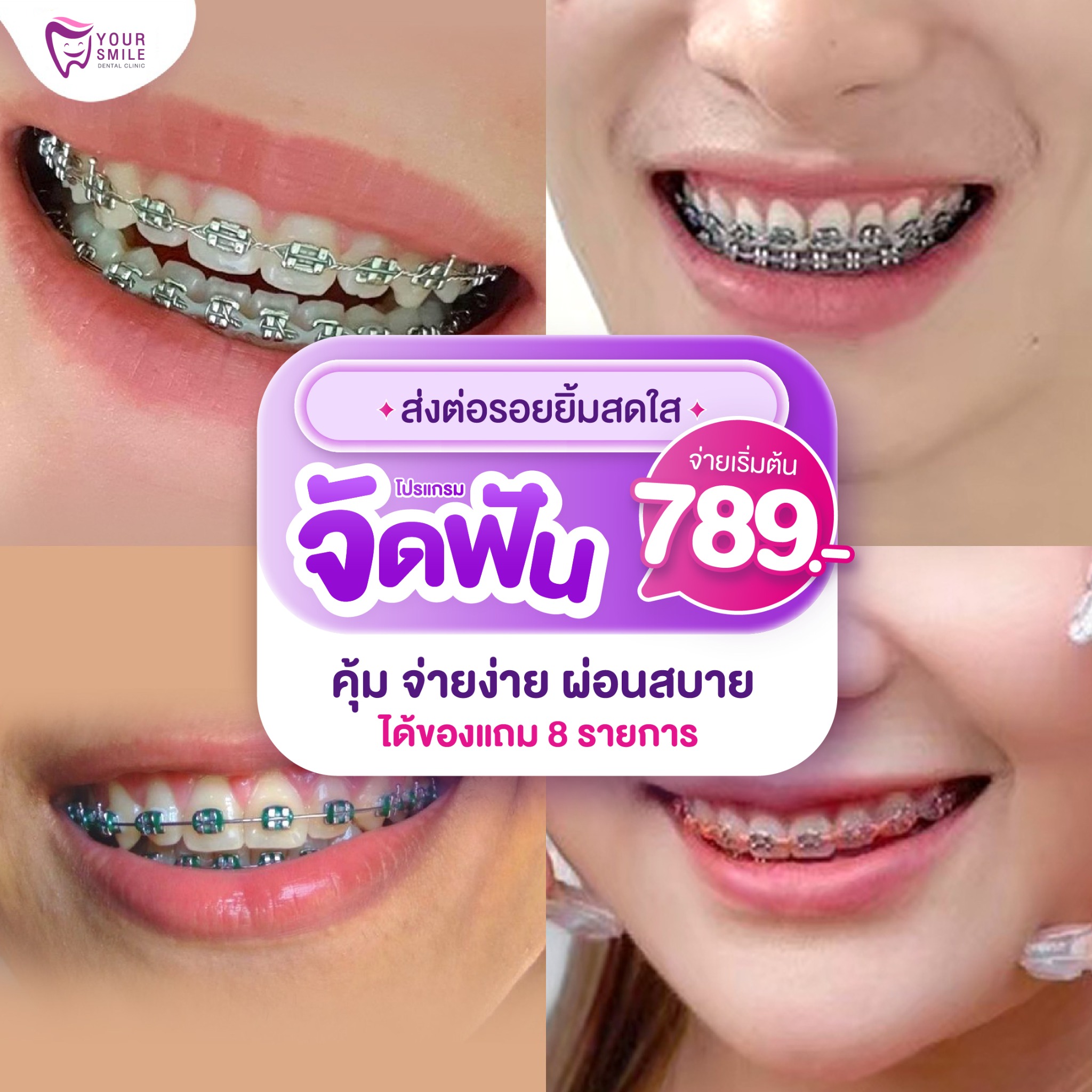 Your smile Dental clinic จัดฟัน จัดฟันใส รากฟันเทียม วีเนียร์ Facebook ad