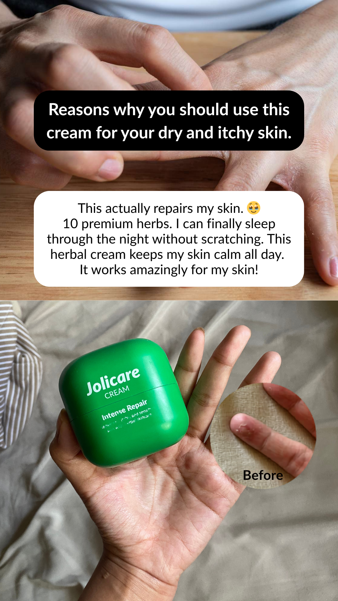 Jolicare Facebook ad