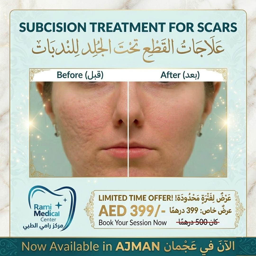 Rami medical center ADS Facebook ad: تخلص من ندبات حب الشباب نهائياً!