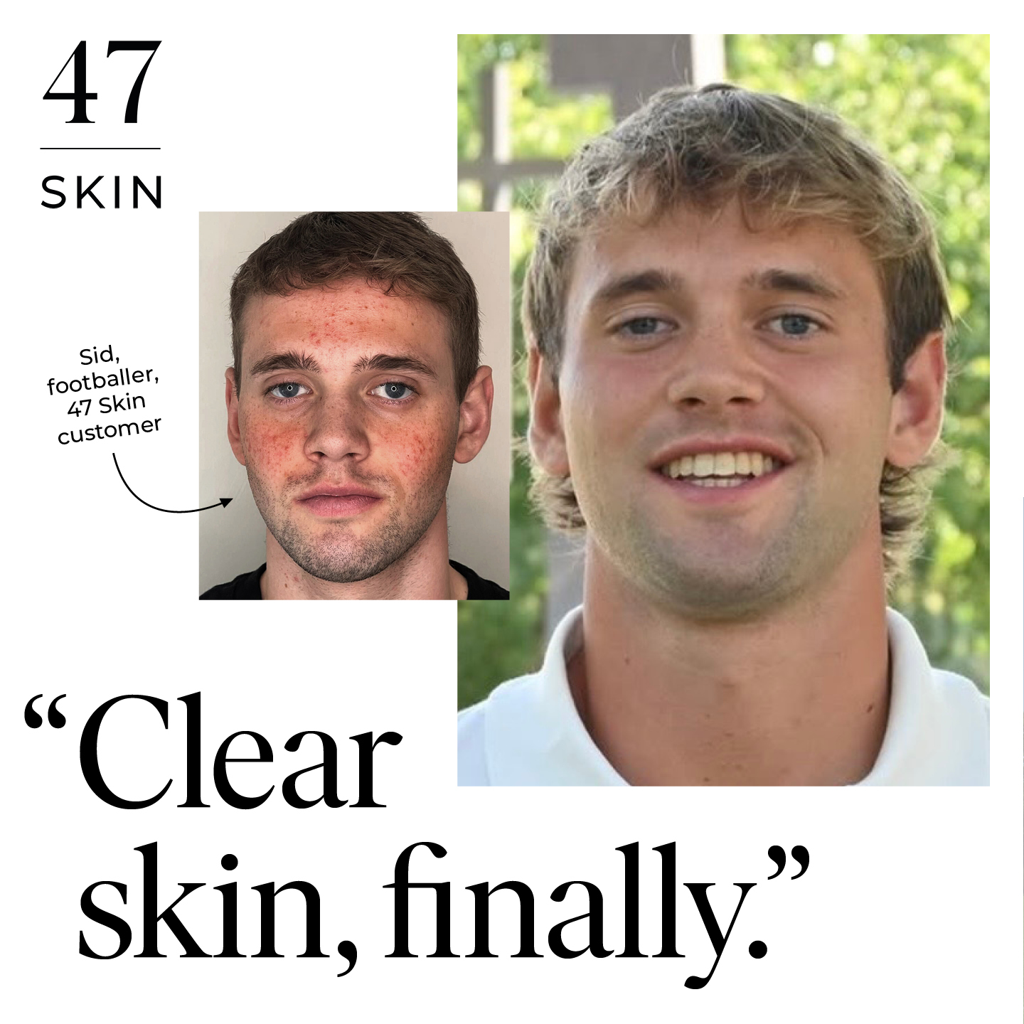 47Skin Facebook ad