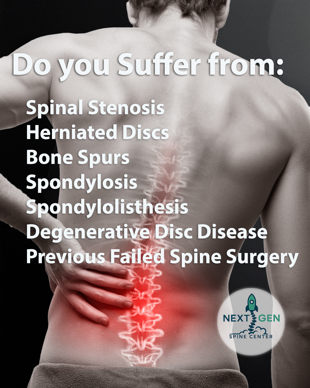 NextGen Spine Center Facebook ad: Is a pinched nerve ruining your life? NextGen Spine is the…