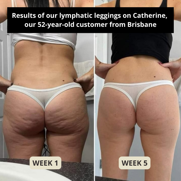 Myriam Cunnigham Facebook ad