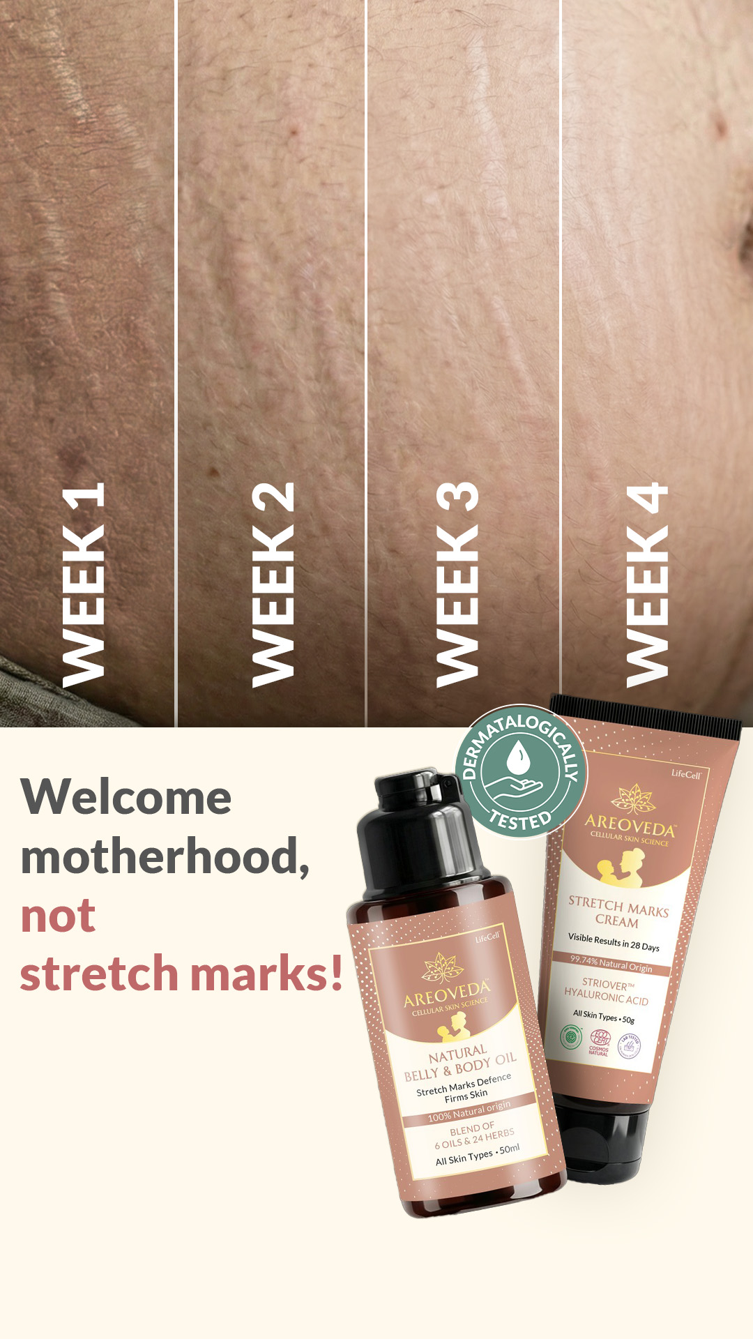 AreoVeda Facebook ad