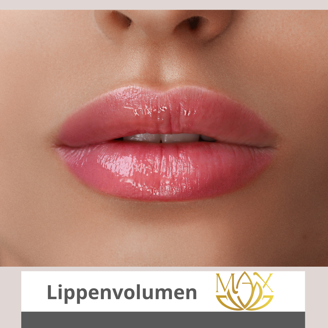 Medical Aesthetics Xperts - MAX Facebook ad