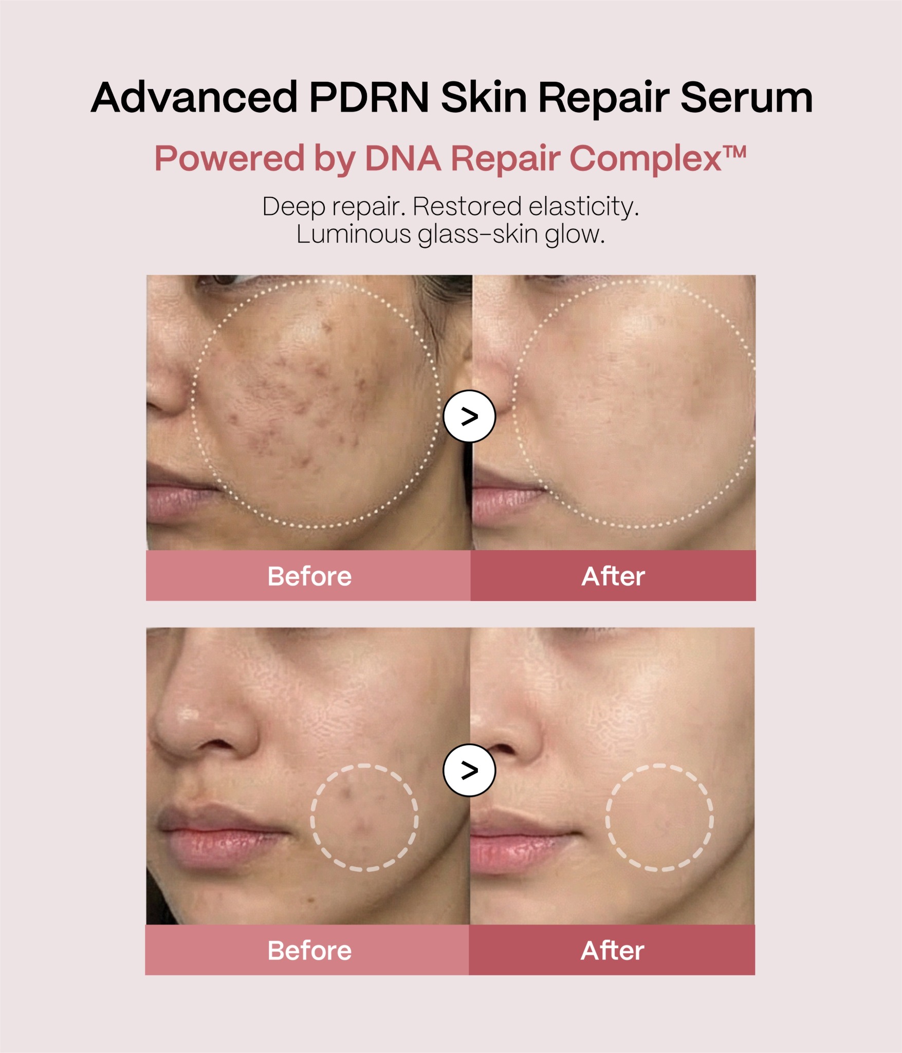 Skin Deep Facebook ad
