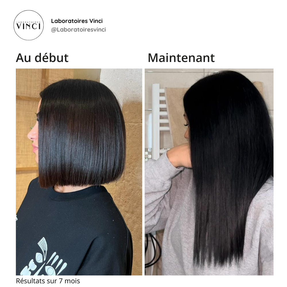 Laboratoires Vinci Facebook ad